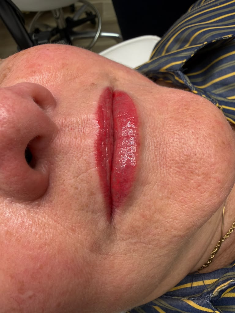 Lip Micropigmentation
